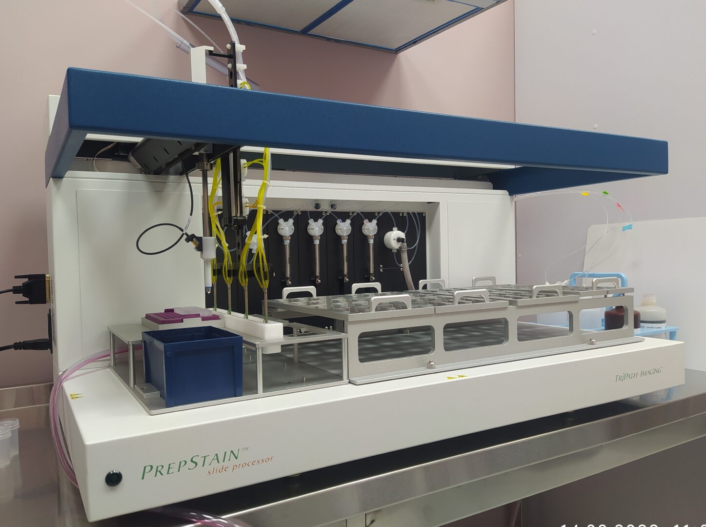 Інноваційний метод цитологічного дослідження!